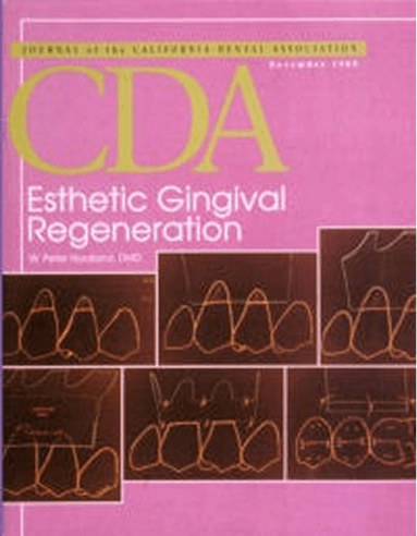 Gingival Regeneration Principles