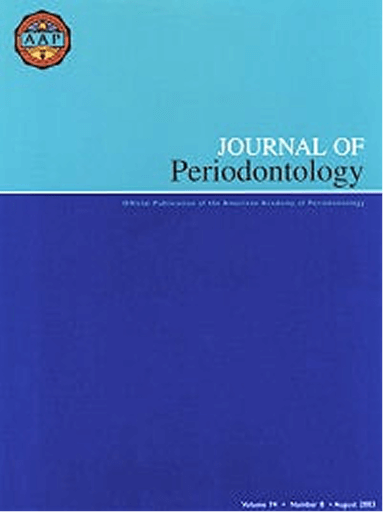 Classification for Loss of Papillary Height
