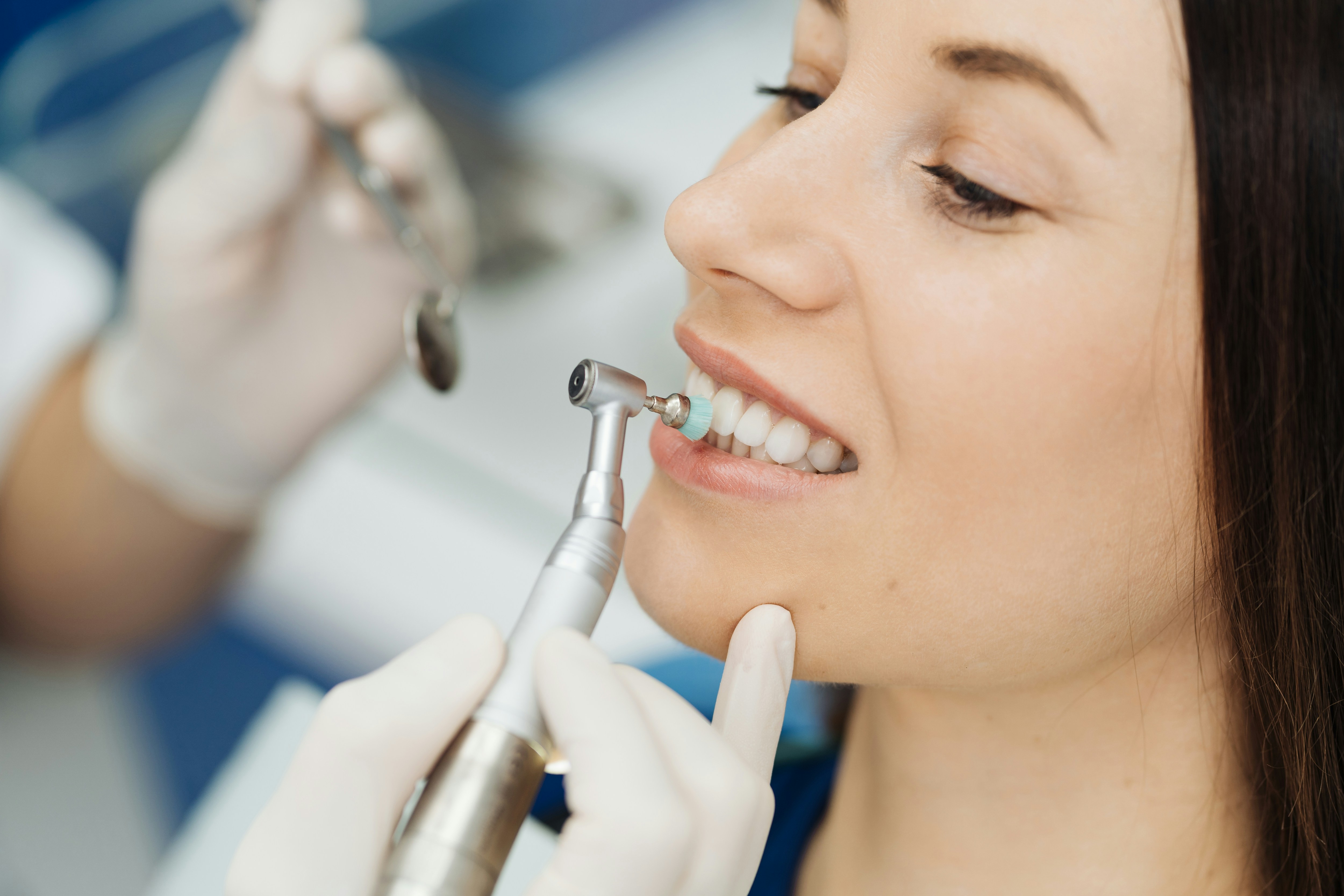 Prophylaxis (Teeth Cleaning)