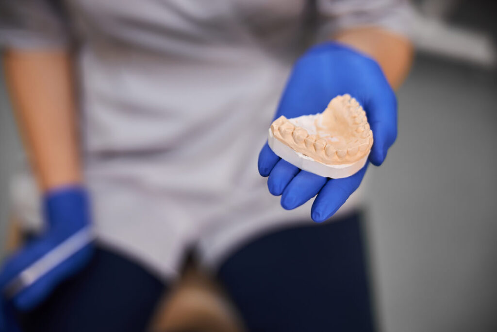 Dental technician holding a plaster model of teeth - Oral Plastic Surgery & Periodontics