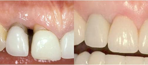 Mary M. Before After